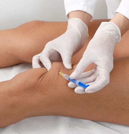 Otsonoterapia